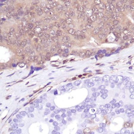Immunohistochemistry (Formalin/PFA-fixed paraffin-embedded sections) - Anti-PTEN antibody [SP218] - BSA and Azide free (ab243940), expandable thumbnail