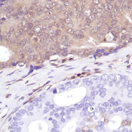 Immunohistochemistry (Formalin/PFA-fixed paraffin-embedded sections) - Anti-PTEN antibody [SP218] - BSA and Azide free (AB243940)