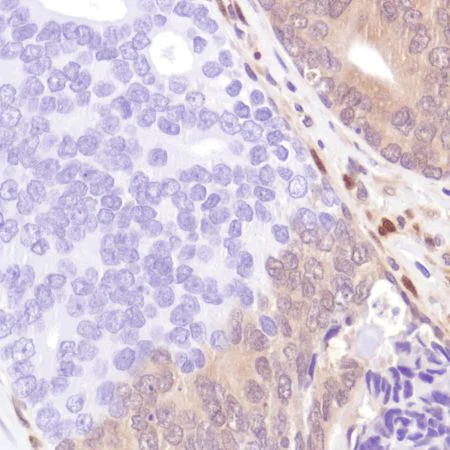 Immunohistochemistry (Formalin/PFA-fixed paraffin-embedded sections) - Anti-PTEN antibody [SP218] - BSA and Azide free (AB243940)