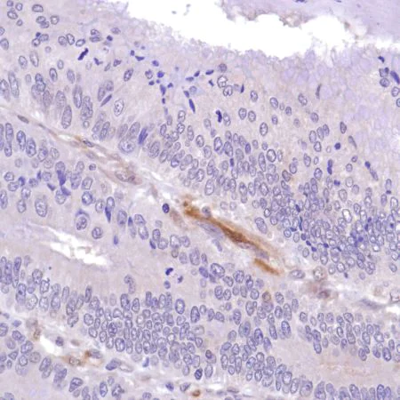 Immunohistochemistry (Formalin/PFA-fixed paraffin-embedded sections) - Anti-PTEN antibody [SP218] - BSA and Azide free (AB243940)