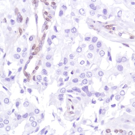 Immunohistochemistry (Formalin/PFA-fixed paraffin-embedded sections) - Anti-PTEN antibody [SP218] - BSA and Azide free (ab243940), expandable thumbnail