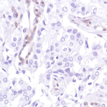 Immunohistochemistry (Formalin/PFA-fixed paraffin-embedded sections) - Anti-PTEN antibody [SP218] - BSA and Azide free (AB243940)
