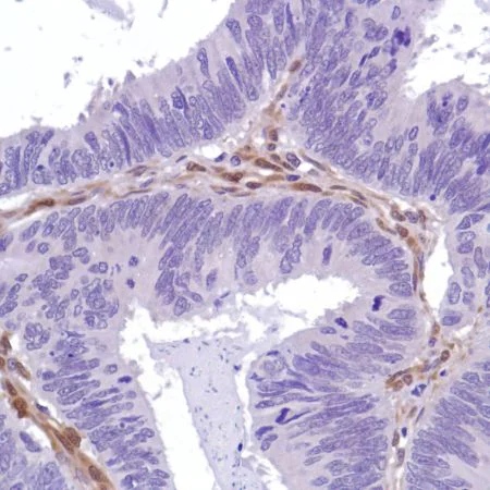 Immunohistochemistry (Formalin/PFA-fixed paraffin-embedded sections) - Anti-PTEN antibody [SP218] - BSA and Azide free (AB243940)