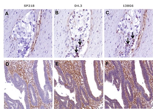 Immunohistochemistry (Formalin/PFA-fixed paraffin-embedded sections) - Anti-PTEN antibody [SP218] - BSA and Azide free (AB243940), expandable thumbnail