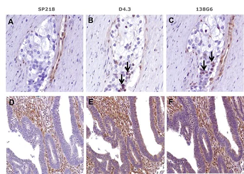 Immunohistochemistry (Formalin/PFA-fixed paraffin-embedded sections) - Anti-PTEN antibody [SP218] - BSA and Azide free (AB243940)