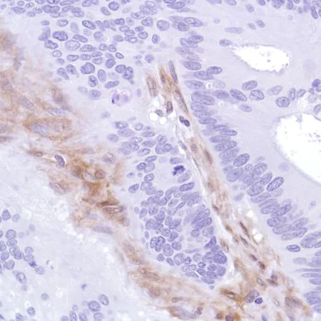 Immunohistochemistry (Formalin/PFA-fixed paraffin-embedded sections) - Anti-PTEN antibody [SP218] - BSA and Azide free (AB243940)
