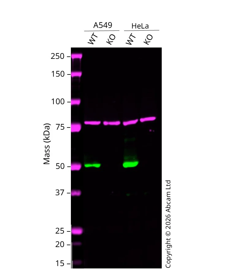 Western blot - Anti-PTEN antibody [SP218] - C-terminal (AB228466)