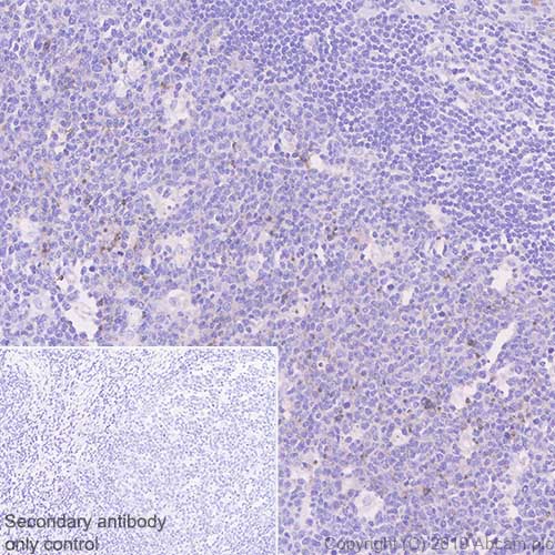 Immunohistochemistry (Formalin/PFA-fixed paraffin-embedded sections) - Anti-PTEN antibody [SP227] (AB227674), expandable thumbnail