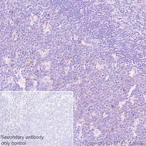 Immunohistochemistry (Formalin/PFA-fixed paraffin-embedded sections) - Anti-PTEN antibody [SP227] (AB227674)
