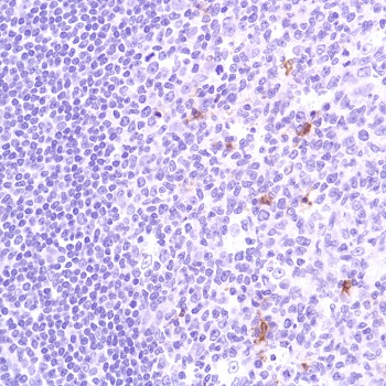 Immunohistochemistry (Formalin/PFA-fixed paraffin-embedded sections) - Anti-PTEN antibody [SP227] (AB227674), expandable thumbnail