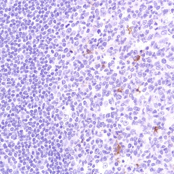 Immunohistochemistry (Formalin/PFA-fixed paraffin-embedded sections) - Anti-PTEN antibody [SP227] (AB227674)