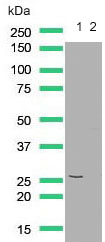 Western blot - Anti-PTEN antibody [SP227] (AB227674), expandable thumbnail