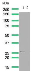 Western blot - Anti-PTEN antibody [SP227] (AB227674)