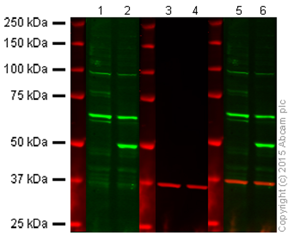 Western blot - Anti-PTEN antibody [Y184] (AB32199), expandable thumbnail