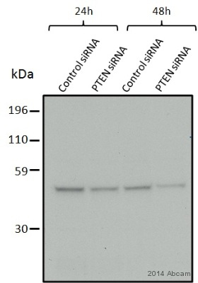 Western blot - Anti-PTEN antibody [Y184] (ab32199), expandable thumbnail