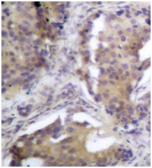 Immunohistochemistry (Formalin/PFA-fixed paraffin-embedded sections) - Anti-PTEN (phospho S370) antibody (AB195056), expandable thumbnail