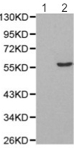 Western blot - Anti-PTEN (phospho S370) antibody (AB195056), expandable thumbnail