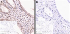 Immunohistochemistry (Formalin/PFA-fixed paraffin-embedded sections) - Anti-PTEN (phospho T366) antibody [EP229] (AB109454), expandable thumbnail