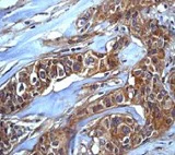 Immunohistochemistry (Formalin/PFA-fixed paraffin-embedded sections) - Anti-PTEN (phospho T366) antibody [EP229] - BSA and Azide free (AB208104)