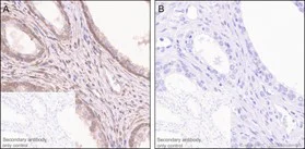Immunohistochemistry (Formalin/PFA-fixed paraffin-embedded sections) - Anti-PTEN (phospho T366) antibody [EP229] - BSA and Azide free (AB208104)