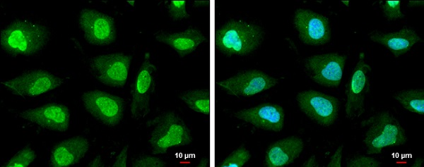 Immunocytochemistry/ Immunofluorescence - Anti-PTEN (phospho T366 + S370) antibody (AB226801), expandable thumbnail