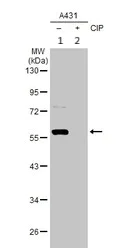 Western blot - Anti-PTEN (phospho T366 + S370) antibody (AB226801)