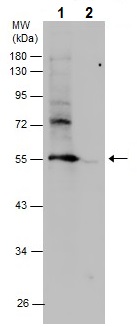Western blot - Anti-PTEN (phospho T366 + S370) antibody (AB226801), expandable thumbnail
