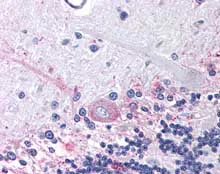 Immunohistochemistry (Formalin/PFA-fixed paraffin-embedded sections) - Anti-PTGER3 antibody (AB115667)