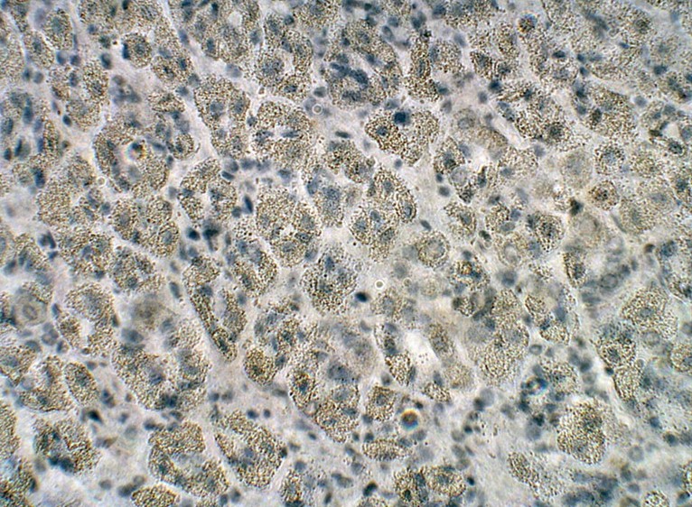 Immunohistochemistry (Formalin/PFA-fixed paraffin-embedded sections) - Anti-PTGER3 antibody (AB21227)