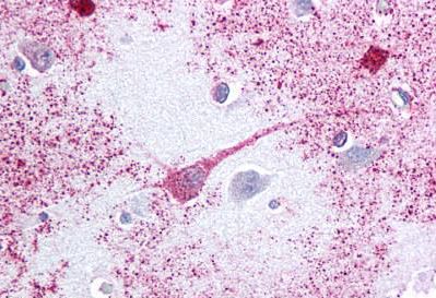Immunohistochemistry (Formalin/PFA-fixed paraffin-embedded sections) - Anti-PTGER3 antibody - Cytoplasmic domain (AB189122)