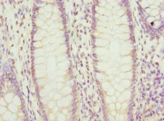 Immunohistochemistry (Formalin/PFA-fixed paraffin-embedded sections) - Anti-PTGES2/Gbf1 antibody (AB229961)