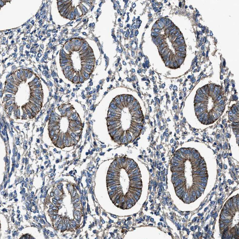 Immunohistochemistry (Formalin/PFA-fixed paraffin-embedded sections) - Anti-PTGFRN antibody (AB224392)