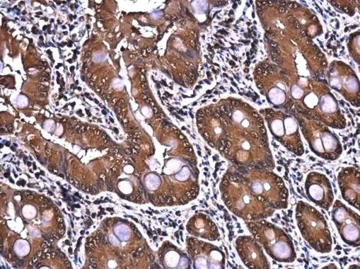Immunohistochemistry (Formalin/PFA-fixed paraffin-embedded sections) - Anti-PTGFRN antibody (AB97567)