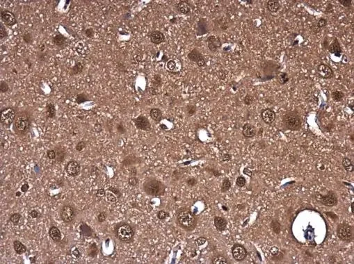 Immunohistochemistry (Formalin/PFA-fixed paraffin-embedded sections) - Anti-PTGFRN antibody (AB97567)