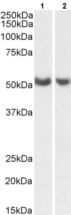 Western blot - Anti-PTGIS/PGIS antibody (AB223578)