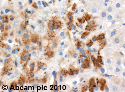 Immunohistochemistry (Formalin/PFA-fixed paraffin-embedded sections) - Anti-PTGIS/PGIS antibody (AB23668), expandable thumbnail