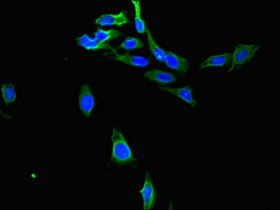 Immunocytochemistry/ Immunofluorescence - Anti-PTGR1 antibody (AB222818)