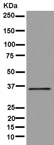 Western blot - Anti-PTGR1 antibody [EPR13451-10] (AB181131)