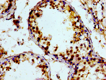 Immunohistochemistry (Formalin/PFA-fixed paraffin-embedded sections) - Anti-PTGR2 antibody (AB236891)