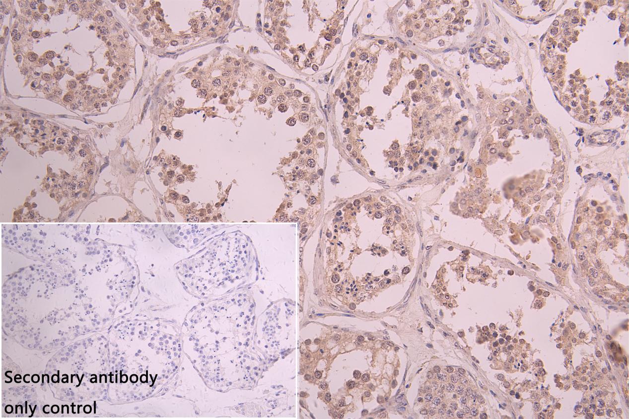 Immunohistochemistry (Formalin/PFA-fixed paraffin-embedded sections) - Anti-PTGR2 antibody (AB236891)
