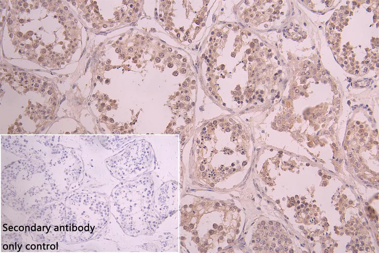 Immunohistochemistry (Formalin/PFA-fixed paraffin-embedded sections) - Anti-PTGR2 antibody (AB236891)