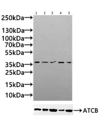 Western blot - Anti-PTGR2 antibody (AB236891)