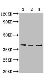 Western blot - Anti-PTGR2 antibody (AB236891)
