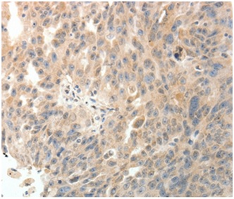 Immunohistochemistry (Formalin/PFA-fixed paraffin-embedded sections) - Anti-PTHLH antibody (AB197358)