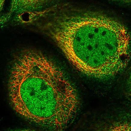 Immunocytochemistry/ Immunofluorescence - Anti-PTHLH antibody (AB224503)