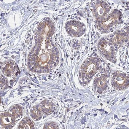Immunohistochemistry (Formalin/PFA-fixed paraffin-embedded sections) - Anti-PTHLH antibody (AB224503)