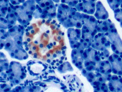 Immunohistochemistry (Formalin/PFA-fixed paraffin-embedded sections) - Anti-PTHLH antibody [D1] (AB239527)