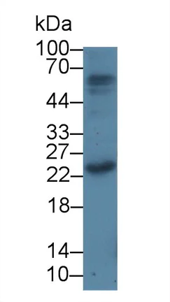 Western blot - Anti-PTHLH antibody [D1] (AB239527)