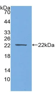 Western blot - Anti-PTHLH antibody [D1] (AB239527)