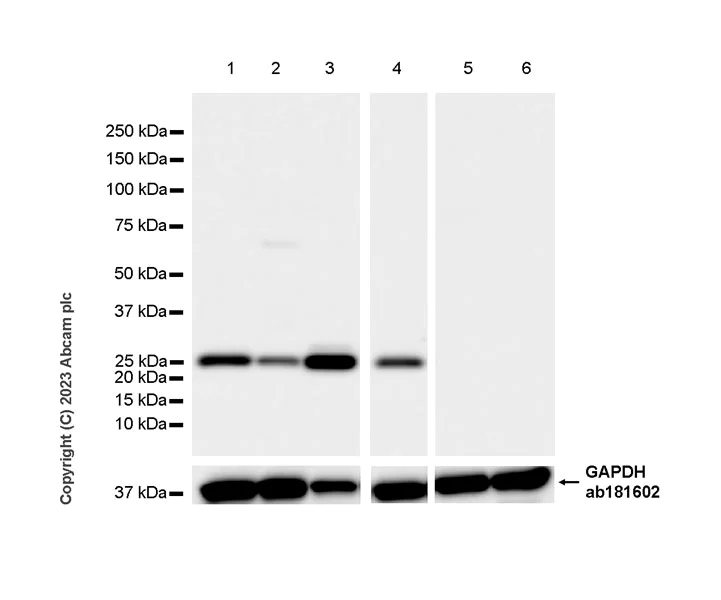 Western blot - Anti-PTHLH antibody [EPR26606-236] - BSA and Azide free (AB314119)